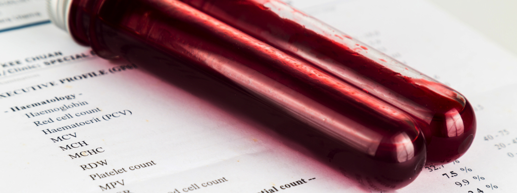 Blood Testing Sample, Credit: Stock Photography